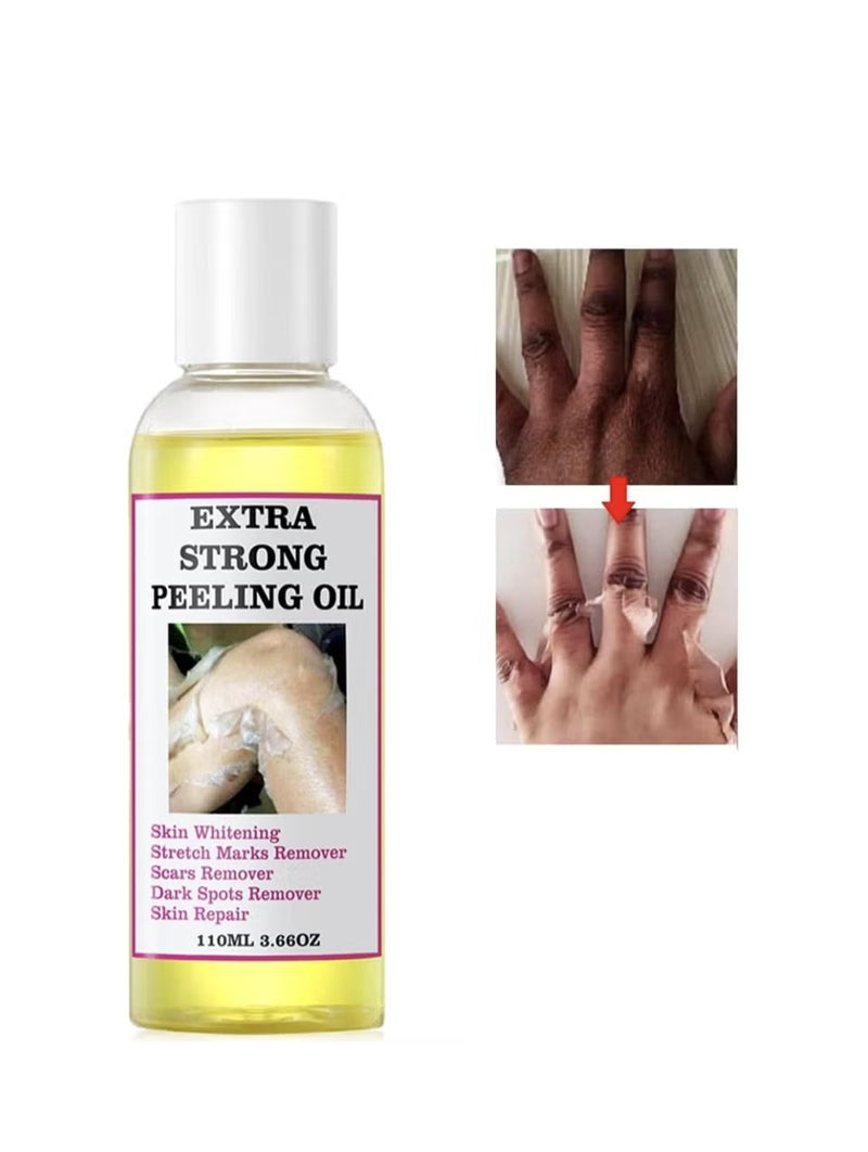 MOOYAM
Super Strength Yellow Peeling Oil Exfoliating Dark Skin for Body